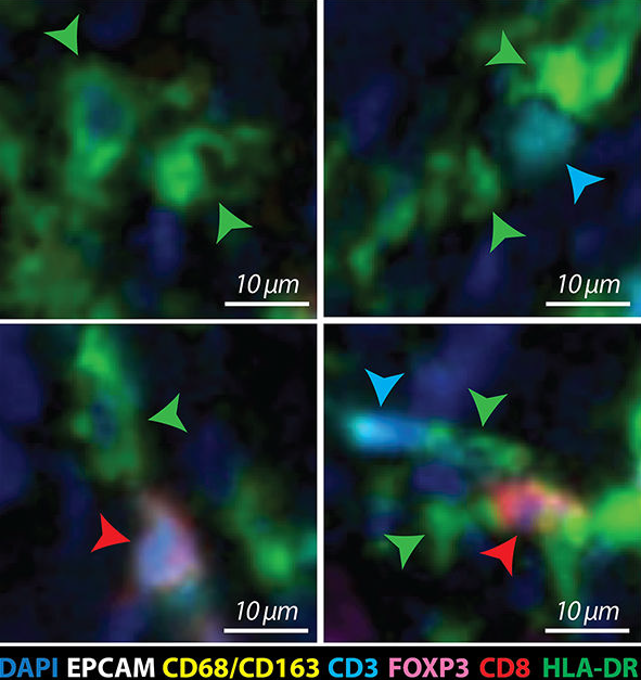 Three-cell immune triad: dendritic cell, helper T cell, and killer T cell in close contact